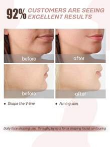 larrycard 1pc Women V Line Facial Bandage Lifting Face Shaper Straps Fajas