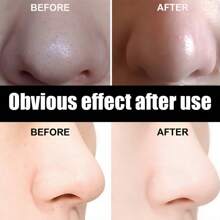 Carbon Blackhead Removal Mask, 10 Nose Patches, Peel-Off Mask, Pore Whitehead Cleaner, Strawberry Nose Clear, Deep Cleansing, Suitable For All Skin Types - Black - View 7