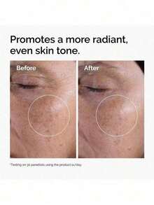 The Ordinary ácido glicólico 7% exfoliante 240ml uso nocturno todo tipo de piel cuidado facial elimina células muertas revitaliza rostro skincare cosmético tratamiento belleza - Multicolor - Ver 3