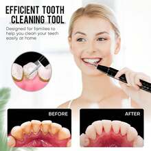 1 Set Electric Tartar Eraser With LED Light, Tartar Eraser Cleaning Tool, 4 Replaceable Blades And 4 Dental Care Modes For Cleaning Teeth And Removing Tartar From Teeth, Father's Day Mother's Day Valentine's Day Gift (USB Rechargeable) - 黑色 - 查看 1