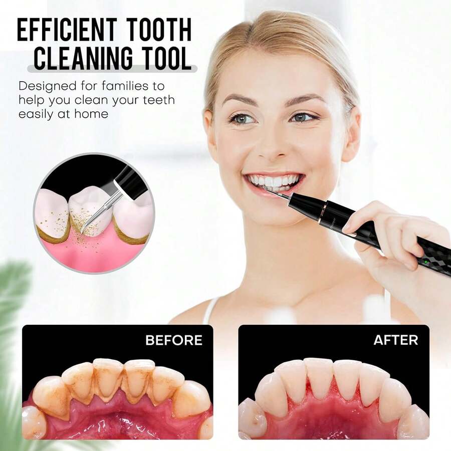 1 Set Electric Tartar Eraser With LED Light, Tartar Eraser Cleaning Tool, 4 Replaceable Blades And 4 Dental Care Modes For Cleaning Teeth And Removing Tartar From Teeth, Father's Day Mother's Day Valentine's Day Gift (USB Rechargeable) - 黑色 - 查看 1