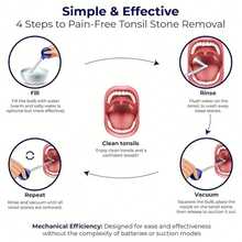 1 Set Tonsil Stone Removal Tool Kit, Includes PVC Suction Ball, Oral Hygiene Suction Ball, Cupping Device, Rubber Tip Gum Stimulator - Multicolor - View 8