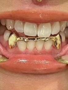 1 Set Of 6 Fang Teeth, Vampire Teeth Combination, Halloween Stage Wear Prop, Funny Hip-Hop Cosplay Accessory, Unisex, Includes Dental Wax For Wearing - Multicolor - View 3