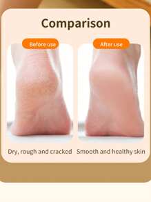 Nuovo lima elettrica portatile, ricaricabile e senza fili per rimuovere calli e pelle morta sui talloni, con 2 velocità regolabili e luce LED, essenziale per casa, spa e viaggi, perfetto per diabetici, runner e anziani, ottimo regalo per la Festa della Mamma e San Valentino, impermeabile e silenzioso (include 3 rulli di ricambio), ottimo regalo di Natale