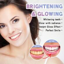 2pcs Teeth Whitening Pen,Tooth Whitening Gel,Travel Suit Tooth Bleach Gel,Stains Personal Oral Hygiene,Gift For Women,Girl And Parents - 紫色 - 查看 2