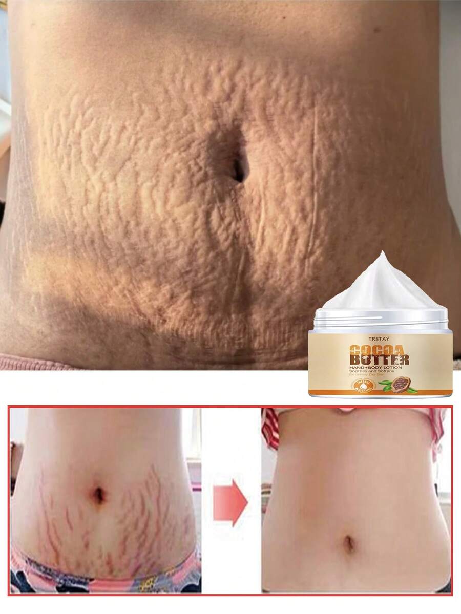 TRSTAR: Nourish And Tighten The Skin, Leaving It Visibly Stretched And Suitable For All Skin Types. - Multicolor - View 1