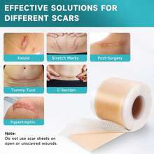 Silicone Scar Sheets, Silicone Scar Tape Strips(1.6"X 60" Roll-1.5M), Professional Away Sheets For Surgical Scars, Keloid, C-Section, Burn Et - trắng - Xem 3