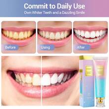 Hailicare Nicotinamide Dazzle White Toothpaste Fresh Breath, Personal Care Protect Teeth Removes Stains Basic Cleaning Oral Care,Freshens Breath Travel Accessories Must Have Teeth Whitening  Hygiene Products Bathroom Accessories Toothpaste - 藍粉紅色 - 查看 3