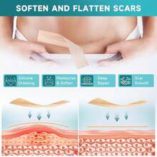 Silicone Scar Sheets, Silicone Scar Tape Strips(1.6"X 60" Roll-1.5M), Professional Away Sheets For Surgical Scars, Keloid, C-Section, Burn Et - trắng - Xem 4