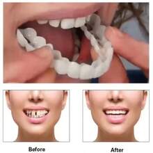 Silicone Denture Set - Temporary Teeth, False Teeth, Natural Dentures, Dental Prosthetics, Dental Veneers, Upper & Lower Denture Set, Easy To Use, Dental Care - Multicolor - View 2