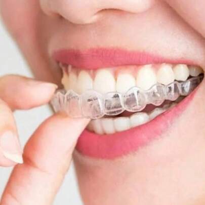 Protetor bucal transparente para clareamento e alisamento dos dentes, 2 peças, acessórios para cuidados bucais sem odor, protetor de dentes para bruxismo, adequado para homens e mulheres, presente ideal para o Dia dos Professores, Halloween, Natal, Ação de Graças, aniversário