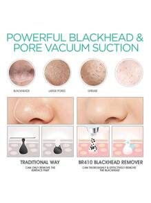 HYUNDAI 六合一电动黑头去除器，带加热功能，便携式USB充电毛孔清洁器，有效清洁面部并去除黑头 - 白色 - 查看 4