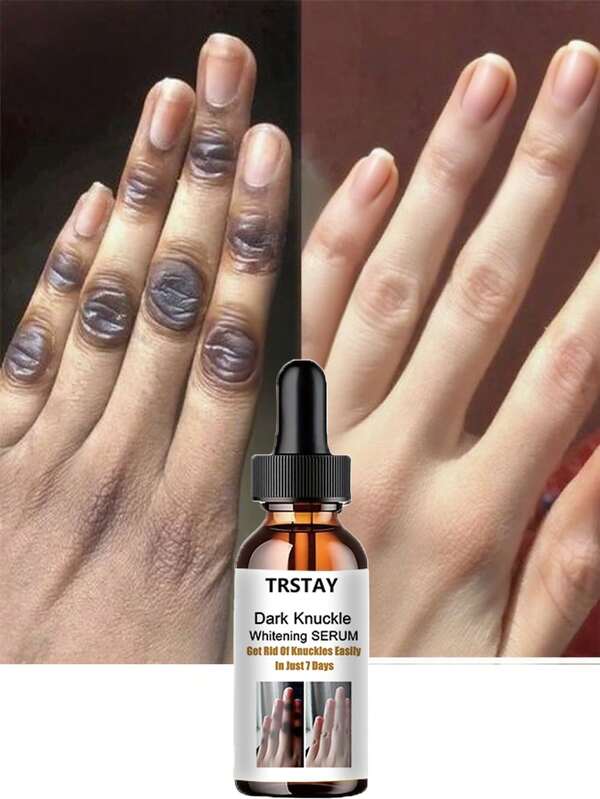 Whitening Soothing Hand Cream For Dry Cracked Skin Deep Hydration And Moisturizing Repairs Rough Texture Regulates Skin Moisture Balance Improves Skin Elasticity Long Lasting Nourishment For Healthy Hands