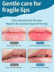 Aquaphor 唇部修复膏，10ml/片 - 深層修護唇膏10ml/支 - 查看 3