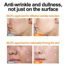 1PC AHA Body Serum,Skin Care ,Essence, Brightening And Repairing,Face Care ,Moisturizing,Skin Firming,Fade Dark Spots ,Pores And Fine Lines,Serum,Make Skin Glow,Soothing Repair - Multicolor - View 4