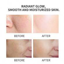 Buy One Get One Free Rice Hyaluronic Acid Serum - 15ml*2pcs, Replenish Collagen, Oil Control, Deep Moisturizing, Smooth And Refreshing Light Beige, Uniform Light Beige, Hypoallergenic, Contains Collagen, Moisturizing Essence | Soothing Light Beige Care | Hypoallergenic Product - trắng - Xem 7