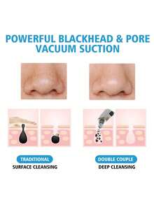 1pc Women's Blackhead Remover Pore Vacuum Cleaner, 3 Suction Levels Blackhead Extractor Pore Cleaner - USB Rechargeable Adult Facial Pore Cleaning Set, Multi-Functional Cleaning Tool, Comes With Cleaning Instructions - Multicolor - View 5