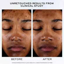 LANCÔME Clarifique Pro-Solution 精华液 50 毫升 - 藍白色 - 查看 5