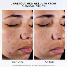 LANCÔME Clarifique Pro-Solution 精华液 50 毫升 - 藍白色 - 查看 4