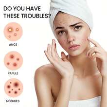 360片水胶体祛痘贴 - 温和不刺激，遮盖痘痘和瑕疵 - 膚色 - 查看 6