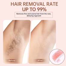 Double-Sided Wax Strips, Suitable For Bikini Line, Brazilian Waxing, Unisex, Can Be Used On Face, Arms, Legs, Back, Armpits, Rose Scented, Suitable For Multiple Skin Tones - Pink - View 5