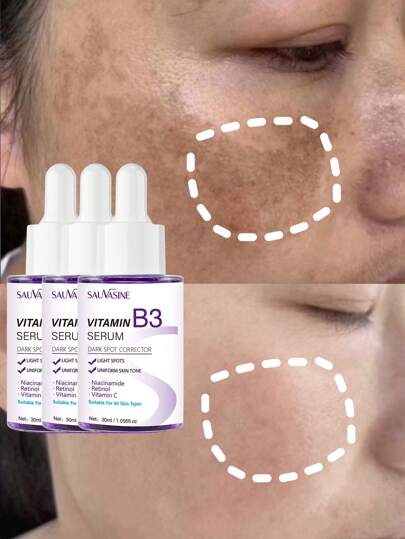 3件套维生素B3祛斑精华液，适用于面部和身体：老年斑、晒斑、雀斑、黄褐斑、褐斑、色素沉着 | 延缓肌肤衰老，减少皱纹和细纹，令肌肤更显年轻紧致。深层补水，锁住水分，持久保湿；亮肤精华液，适用于敏感、不均匀的肌肤。