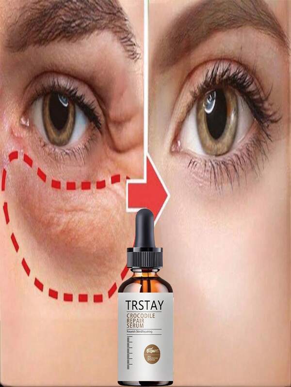 Hydrating Eye Cream For Dark Circles And Puffiness Deep Moisturizing Eye Care Treatment With Natural Extracts To Reduce Wrinkles And Fine Lines Under Eyes 24 Hour Nourishment For Bright Smooth Skin