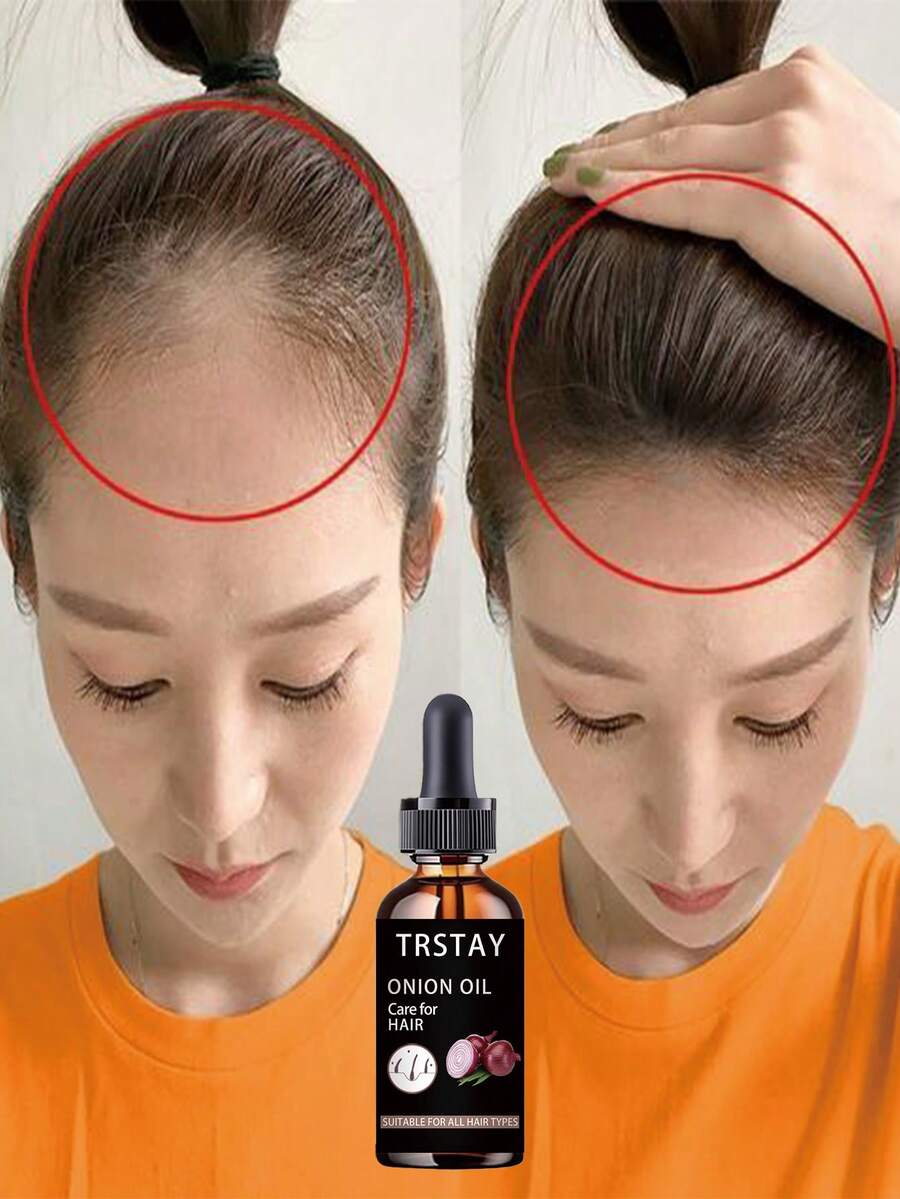 Repair Damaged Curly Hair Structure Lock In Moisture Without Loss Give Hair Flexibility And Elasticity Make Curls More Durable For Healthy Shiny Hair With Natural Bounce And Softness Perfect For Dry Frizzy Hair Types Deep Hydration Oil Control Cleansing Treatment For Curly Hair Restoration - 彩色 - 查看 1