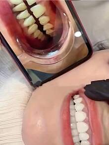 Răng cười trang trí, phụ kiện Halloween, trang phục hàng ngày - trắng - Xem 2