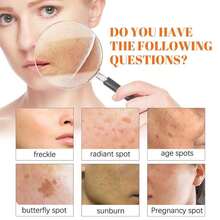 Papaya Brightening & Dark Spot Corrector Cream |   Day Cream W/ Niacinamide + Night Cream W/ Vitamin C |   Soften, Repair & Glow