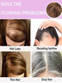 适合头发稀疏女性的真人发片，真人发夹，顶部假发片，增添美丽和自信 - S4/27 - 查看 5