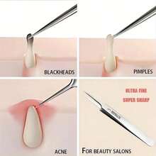 Stainless Steel Acne Needle With Precise Tip Design. Double-Ended Acne Removal Tool With Ring End + Hook End. Precise Cleaning Of Blackheads/Whiteheads/Closed Pores. Same As Beauty Salon Products. Dermatologist Recommended Exfoliation Care. Ergonomic Non-Slip Handle. Long-Lasting Corrosion Resistance And Easy To Disinfect. Suitable For Sensitive Skin Without Damaging Pores. Must-Have For First Aid Of Acne-Prone Skin. Home Beauty Care - Bạc - Xem 1