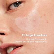 Pimple Patches (6 Sizes 138 Patches), Acne Patches For Large Zit Breakouts, Hydrocolloid Bandages For Face, Chin, Nose, Forehead, Body, Back, Neck & Chest, Oval Hydrocolloid Acne Patches - 6 kích cỡ (138 miếng vá) - Xem 5