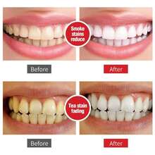 2 piezas sp8 pasta de dientes blanqueadora y cepillos dentales set de cuidado bucal blanqueador limpieza oral higiene completa familiar - Rojo y blanco - Ver 7