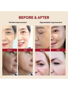 1Pc KOREA SEOUL1988 SERUM:RETINAL LIPOSOME 2%+BLACK GINSENG. Hydrates And Replenishes Moisture, Eliminates Signs Of Fatigue, Prevents Dryness, Brightens Skin Tone, Hydrates, Brightens, Deeply Moisturizes, Improves Elasticity, Smoothes Skin, Makes Skin Radiant, Improves Hydration, Repairs Isolation, Moisturizes And Controls Oil - Multicolor - View 10