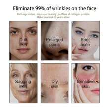 2PCS Rosehip Oil Black Seed And Castor Oil Face Serum, Castor Black Seed Rosehip Serum,Facial Moisturizer Organic Natura - 白色 - 查看 4