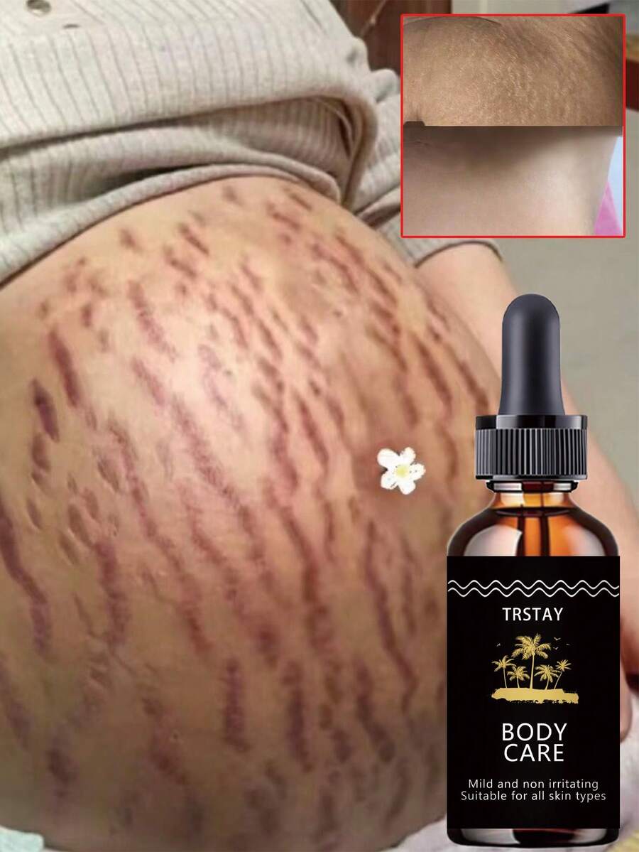 Moisturizing essential oil for delicate skin deep hydration smooth flawless look anti wrinkle natural soothing effect reduce fine lines wrinkles pregnancy stretch marks care - Hyaluronic Acid - Ver 1