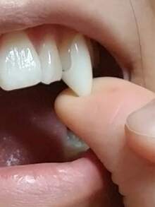 Vampire Fake Fangs Classic PP Halloween Party Cosplay Props, Halloween Costume Party Teeth Vampire Party Gag Teeth Retractable Dentures Party And Dance Costumes - White - View 3