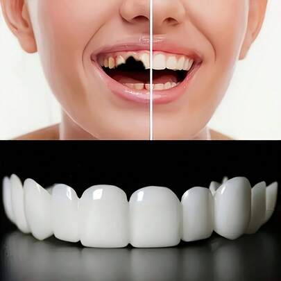 4 piezas de carillas dentales cosméticas simuladas, cómodas y flexibles de color blanco para mejorar la sonrisa perfecta, para uso diario en dientes superiores e inferiores