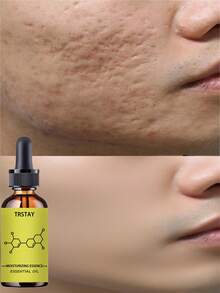 Shrinking And Smoothing Facial Serum With Essential Oils For Pore Refinement And Ceramic Skin Repair Whitening Care Dual Effect Treatment For Radiant Complexion - Nhiều màu - Xem 1