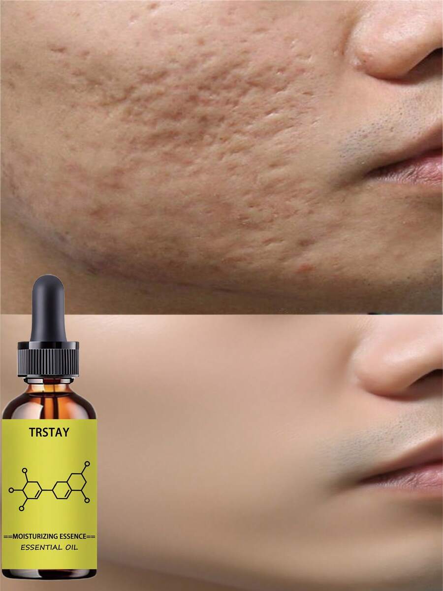 Shrinking And Smoothing Facial Serum With Essential Oils For Pore Refinement And Ceramic Skin Repair Whitening Care Dual Effect Treatment For Radiant Complexion - Nhiều màu - Xem 1
