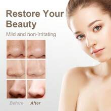 RAF Rechargeable Pore Cleaner, Blackhead Remover, 3 Modes With 5 Suction Tips, Vacuum Negative Pressure Without Damaging Pores, 400mAh Lithium Battery, A Portable Home Dermabrasion Device, Blackhead Cleaning And Beauty Equipment - Portable Facial Pore Cleaner, A Beauty Blackhead Cleaning Device Suitable For Both Women's And Men's Faces