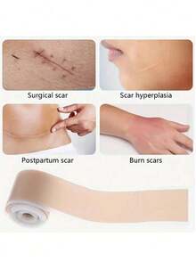 1 Roll Silicone Scar Sheets, Invisible Scar Gel Tape For Covering Scars, Post-Surgery Scars, Hypertrophic Scars, Postpartum Scars And Burn Scars - Best Seller