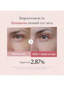 Salmon DNA PDRN Pink Peptide Eye Serum With Niacinamide And 99% Purity Retinol For Fine Lines, Uneven Skin Tone, Korean Skin Care 1.01fl.Oz