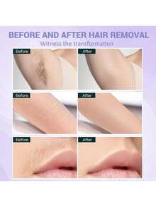 Hard Wax Beads 100G/300 Painless Wax Beans With 5 Applicators Wax Beads Hair Removal For Body Face Bikini Sexy And Hot - Nhiều màu - Xem 3
