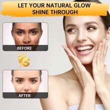 1/3pcs Kojic Acid Soap, Natural Lemon Turmeric Soap Bar With Vitamin C For Dry Sensitive Skin, Turmeric Soap For Face, Body And Hands