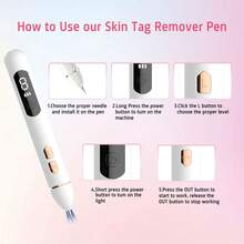 Herramienta Para Quitar Verrugas Pluma Cauterizador - Blanco - Ver 2