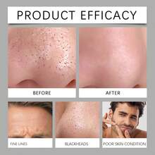 OUHOE Volcanic Mud Soap Deeply Cleanse Facial Pores Remove Blackheads Exfoliation Refreshing Not Greasy Remove Grease Impurities Rejuvenation Facial Body Cleaning Soap - Black - View 8