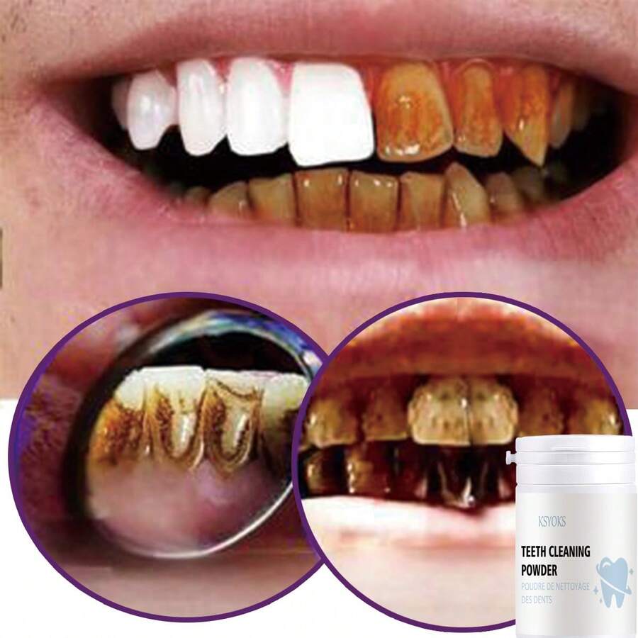 Advanced Teeth Whitening Kit With Deep Moisturizing And Hydrating Formula For Long Lasting Brightness Enhanced Elasticity And Radiant Smile To Boost Vitality - 彩色 - 查看 1