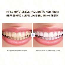 2PCS Premium Niacinamide Whitening Toothpaste, Freshens Breath, Gently Cleanses, Rainbow Color, Whitens Teeth, Deeply Cleans Tooth Stains, Essential For Travel And Home - 預設 - 查看 5
